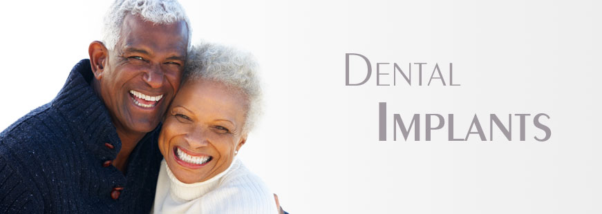 Dental Implants