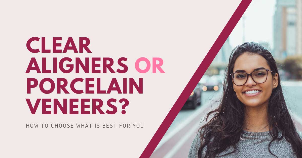 Clear Aligners or Porcelain Veneers?