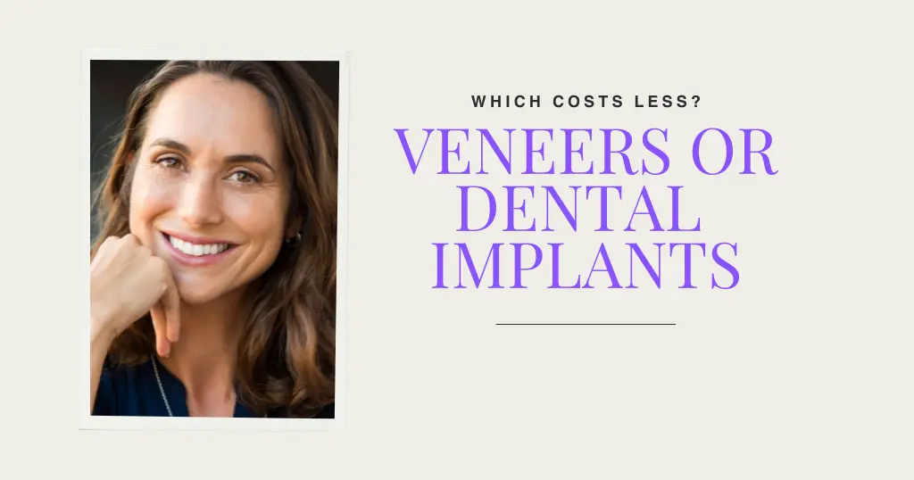 Veneers or Implants Blog Header
