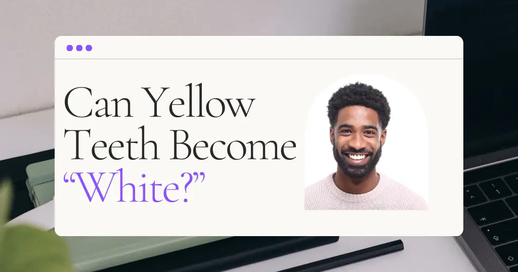 Yellow Teeth Blog Header