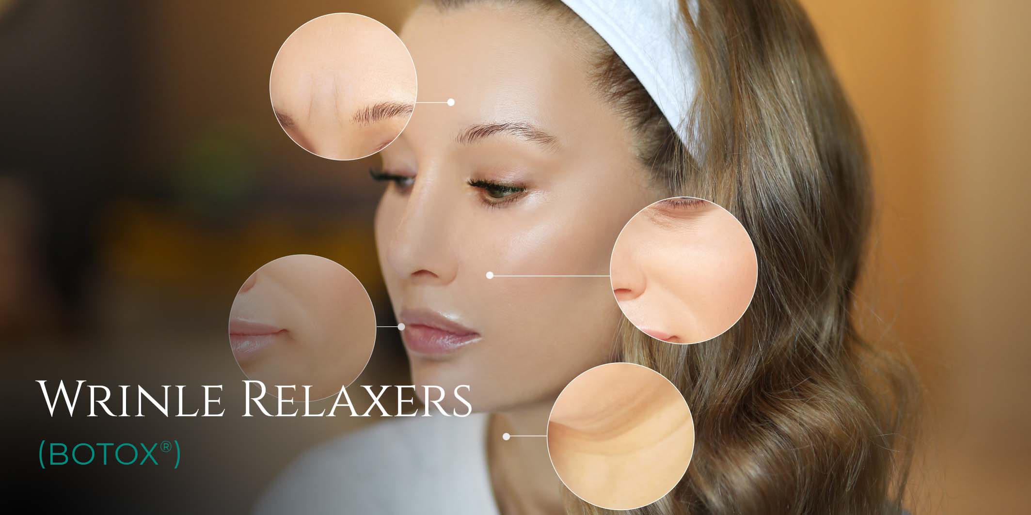 Wrinkle Relaxers Patient Results Examples